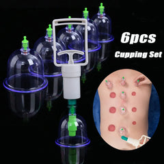 Vacuum Cupping Set