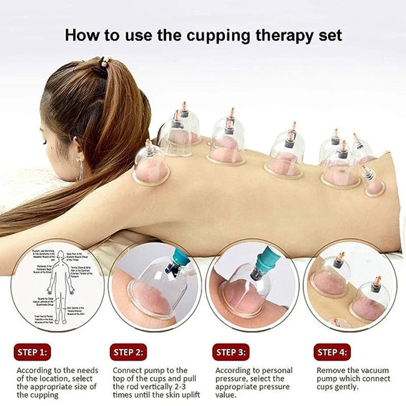 32 Cupping Vacuum Massage