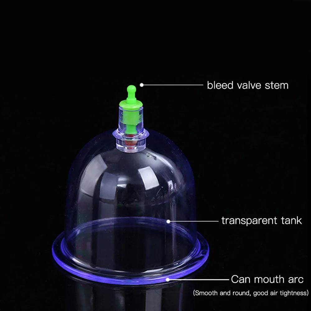 Vacuum Cupping Set