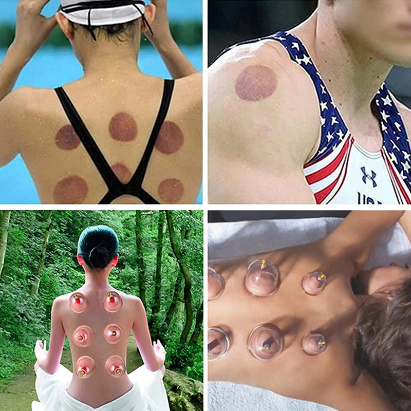 32 Cupping Vacuum Massage